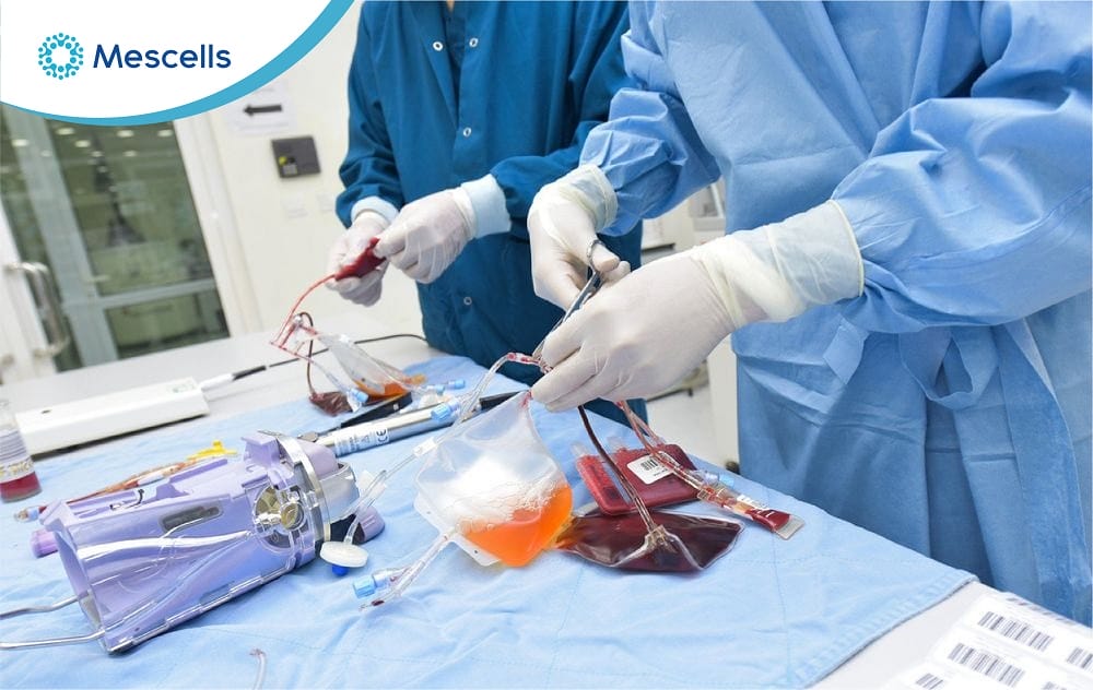 Bảo quản tế bào gốc