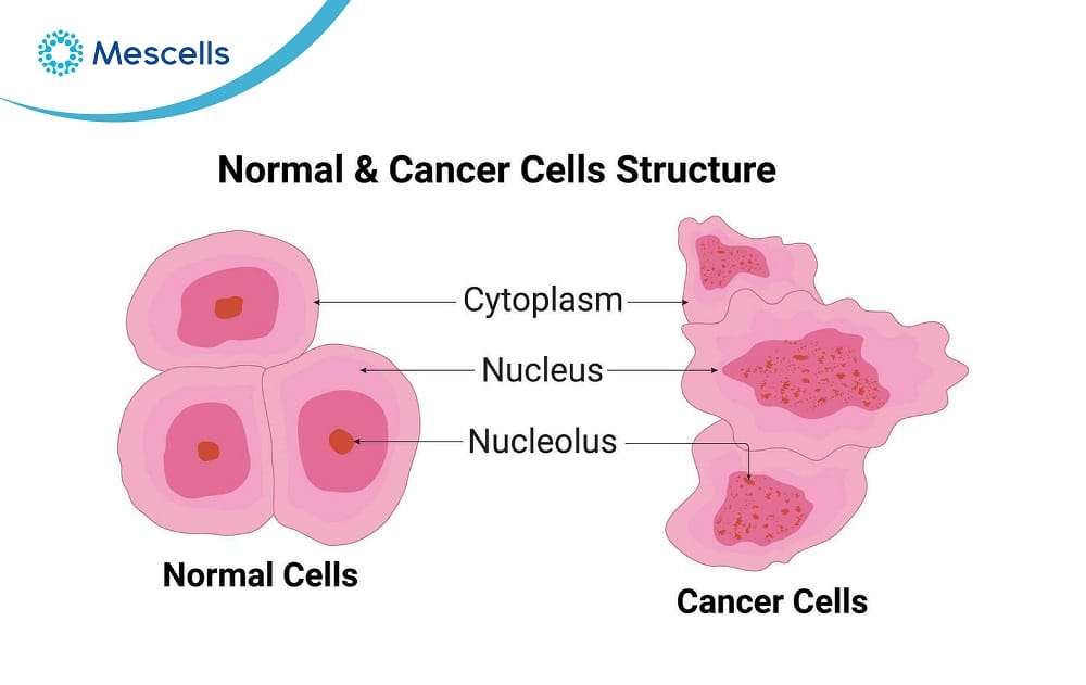 Cần biết về tế bào ung thư