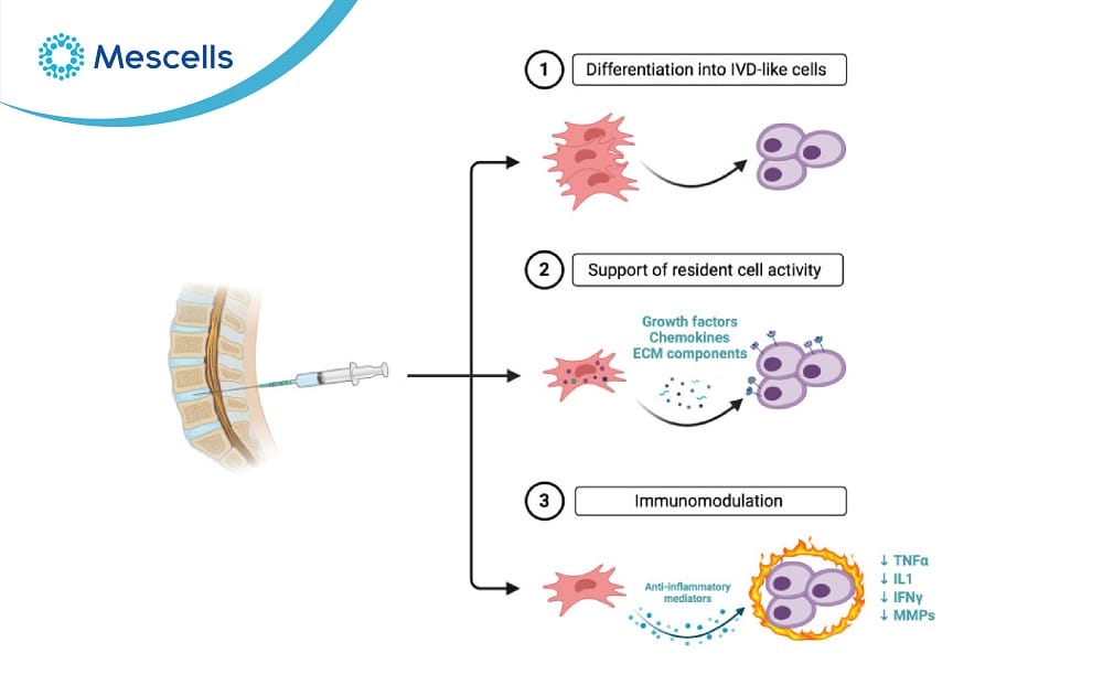 Điều trị thoát vị đĩa đệm bằng tế bào gốc