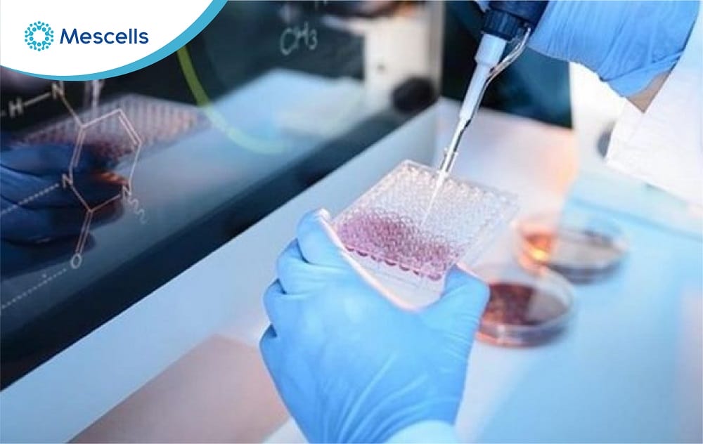 Điều trị thoát vị đĩa đệm bằng tế bào gốc