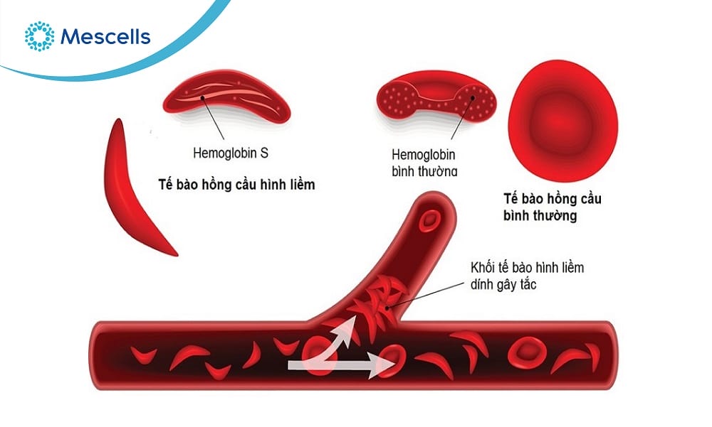 Hồng cầu là gì-05