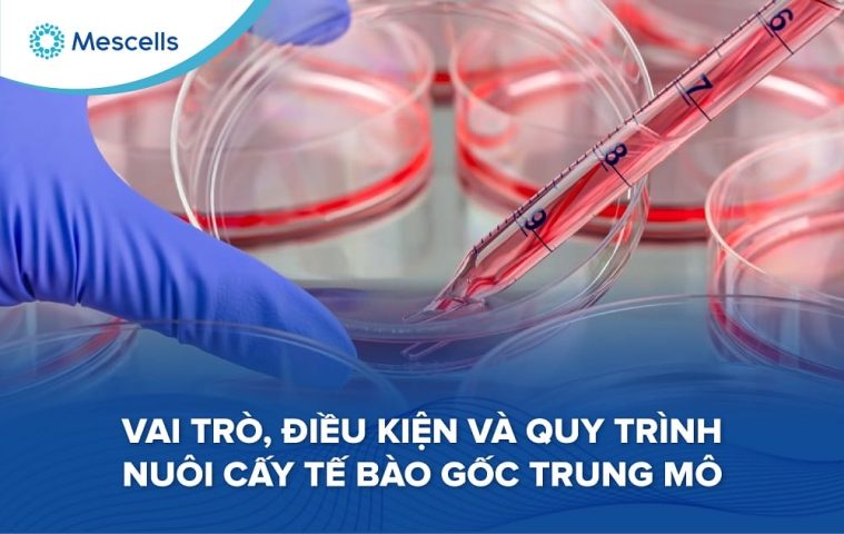 Quy trình nuôi cấy tế bào gốc trung mô