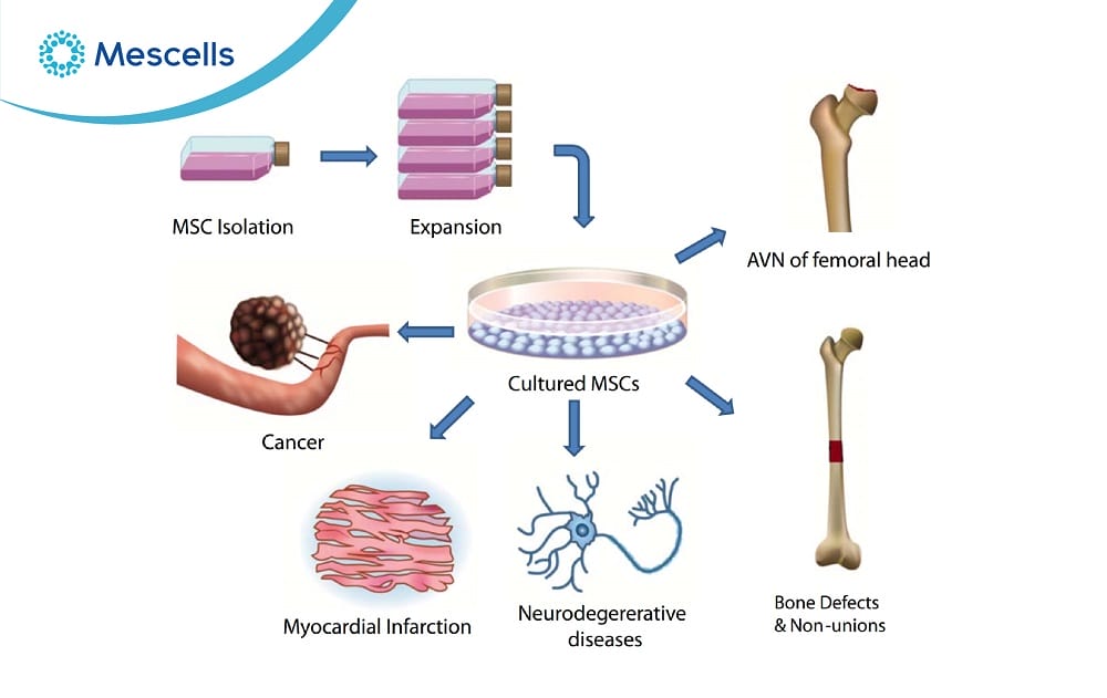 Quy trình nuôi cấy tế bào gốc trung mô
