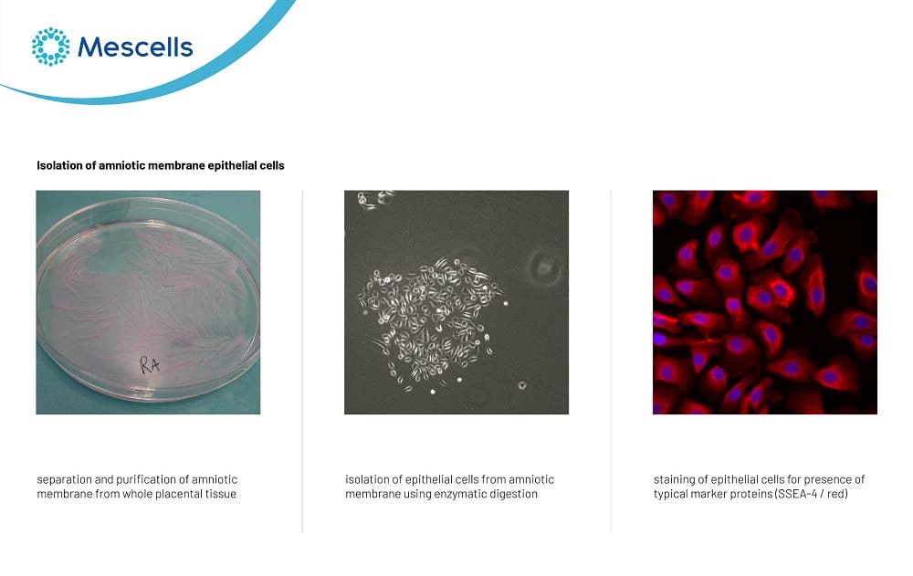 Tế bào biểu mô-05