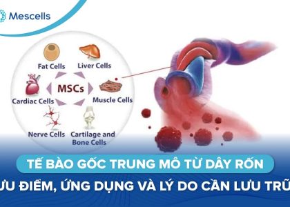 Tế bào gốc trung mô từ dây rốn