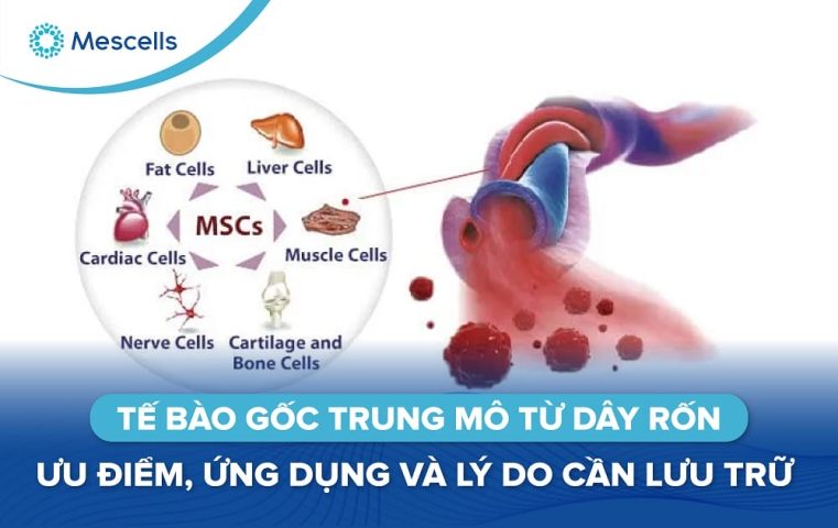 Tế bào gốc trung mô từ dây rốn