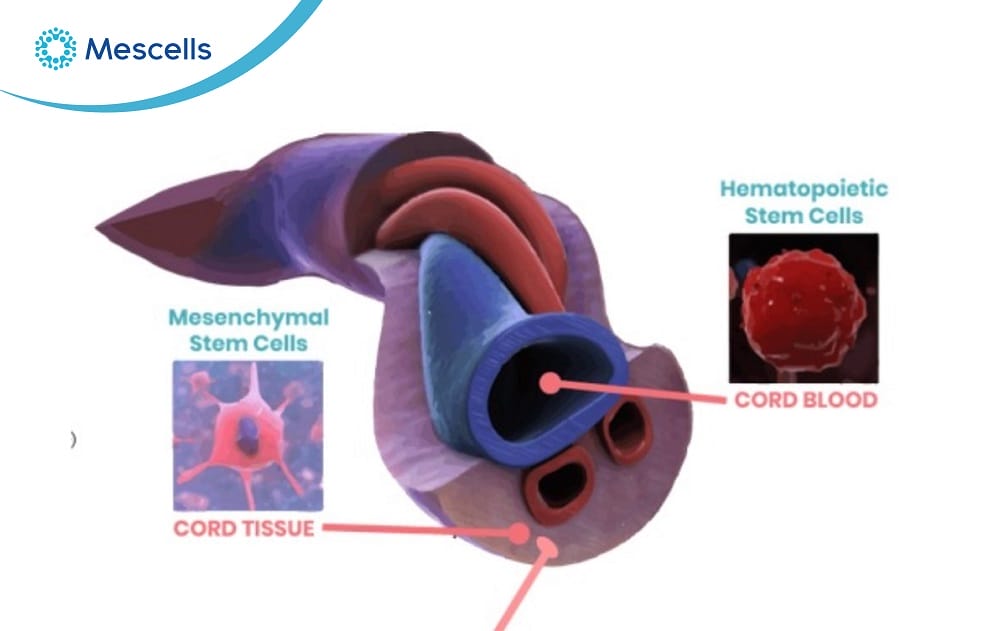 Tế bào gốc trung mô từ dây rốn