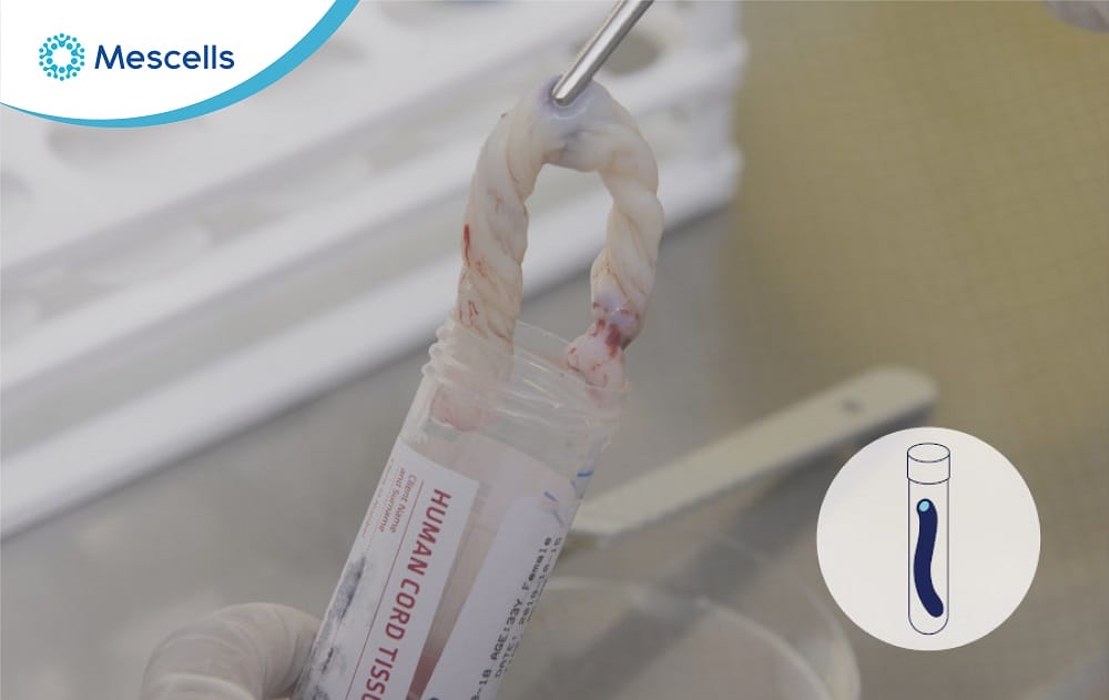 Tế bào gốc trung mô từ dây rốn