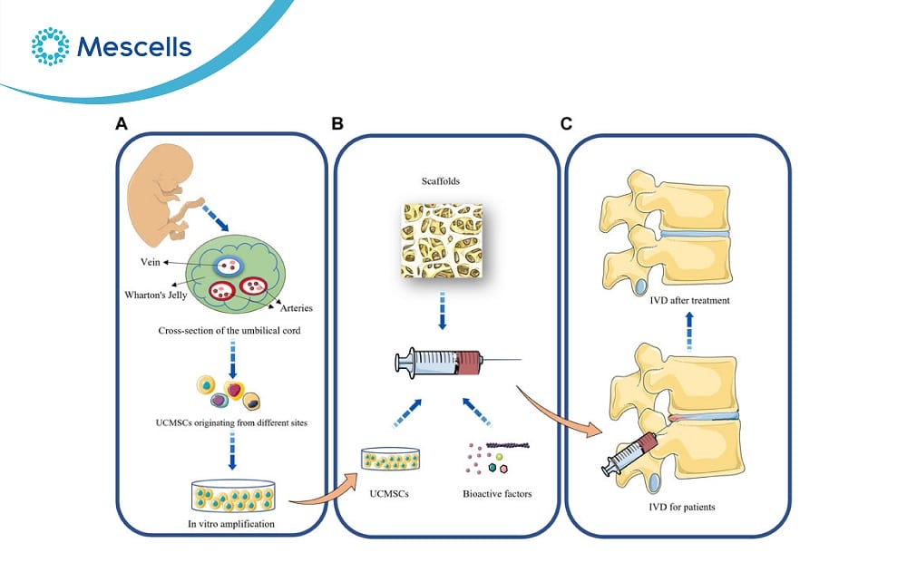 Tế bào gốc trung mô từ dây rốn
