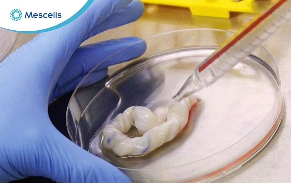 Tế bào gốc trung mô từ dây rốn