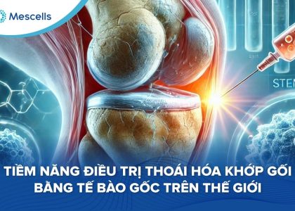 Tiềm năng điều trị thoái hóa khớp gối bằng tế bào gốc-01