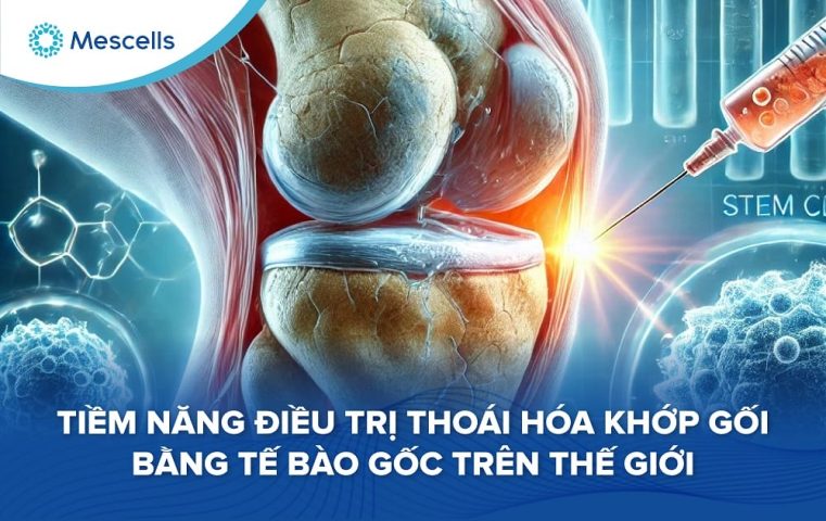 Tiềm năng điều trị thoái hóa khớp gối bằng tế bào gốc-01
