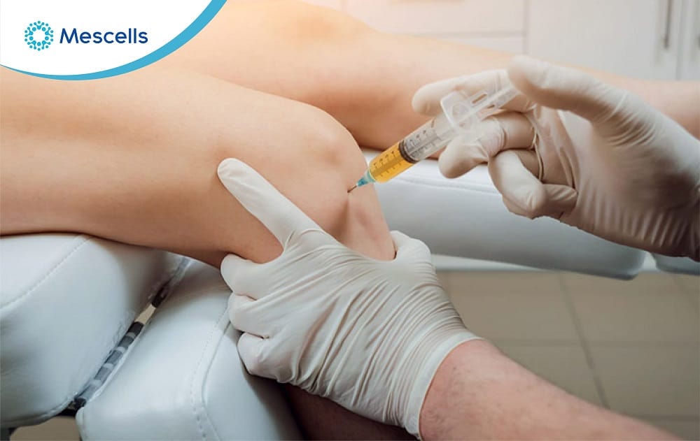 Tiềm năng điều trị thoái hóa khớp gối bằng tế bào gốc-05