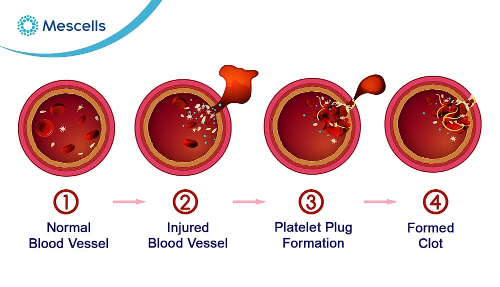 Tiểu cầu là gì