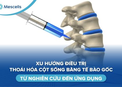 Điều trị thoái hóa cột sống bằng tế bào gốc-01