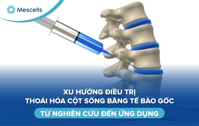 Điều trị thoái hóa cột sống bằng tế bào gốc-01