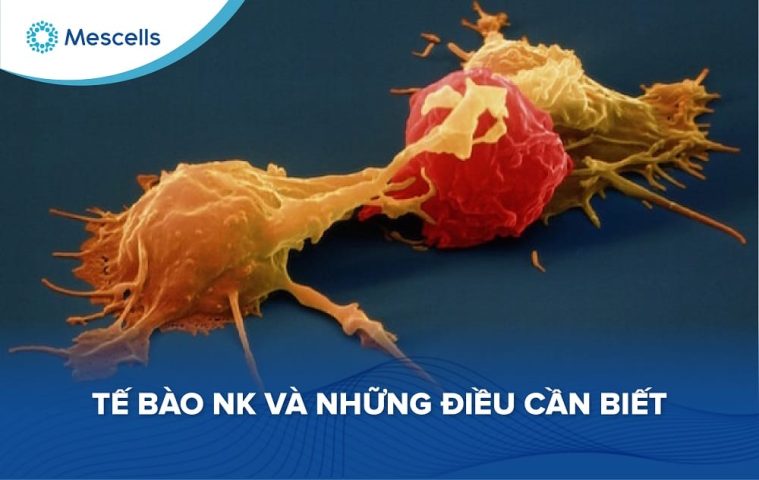 Tế bào NK-01