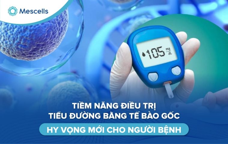 Tiềm năng điều trị tiểu đường bằng tế bào gốc-01
