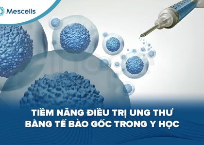Điều trị ung thư bằng tế bào gốc-01