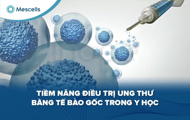 Điều trị ung thư bằng tế bào gốc-01