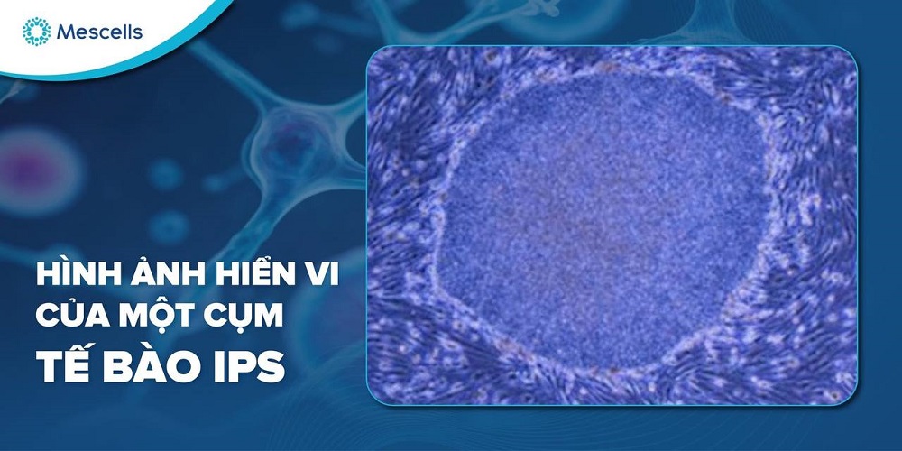 Hình ảnh tế bào gốc iPS