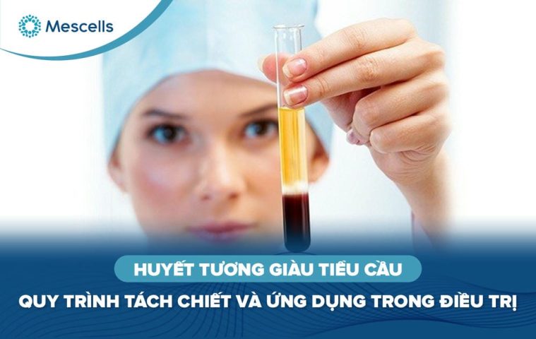 Huyết tương giàu tiểu cầu PRP-01