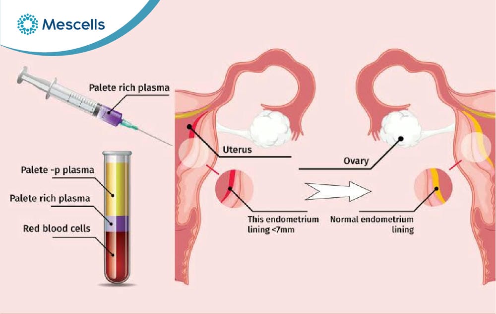 Huyết tương giàu tiểu cầu PRP-06