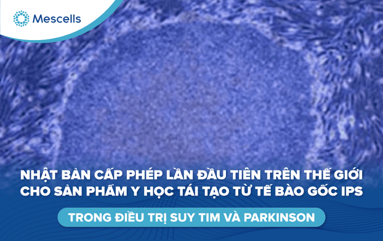 Sản phẩm y học tái tạo từ tế bào gốc ips-01