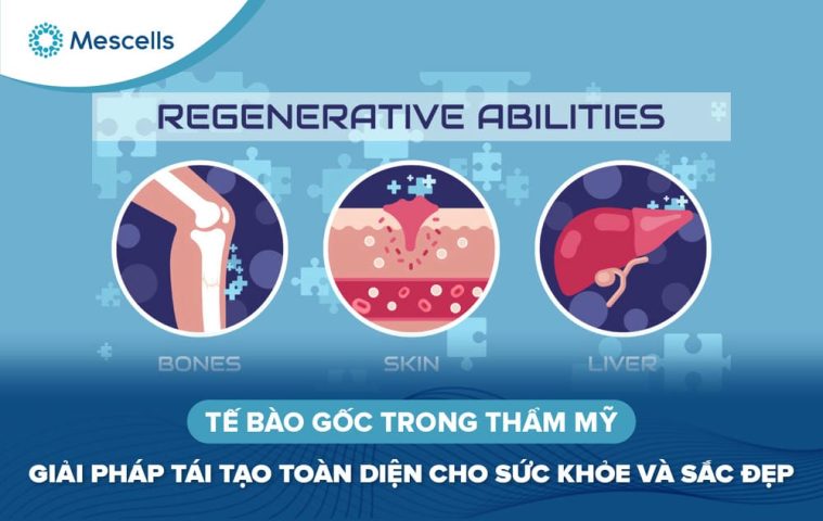 Tế bào gốc trong thẩm mỹ-01