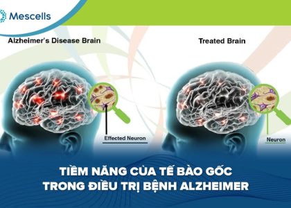 Tiềm năng của tế bào gốc trong điều trị bệnh Alzheimer-01
