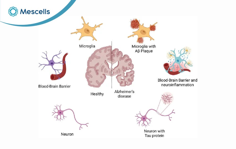 Tiềm năng của tế bào gốc trong điều trị bệnh Alzheimer-02