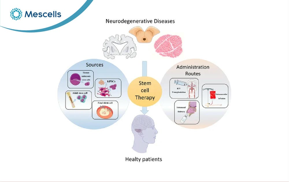 Tiềm năng của tế bào gốc trong điều trị bệnh Alzheimer-08