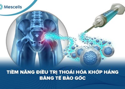 Tiềm năng điều trị thoái hóa khớp háng bằng tế bào gốc-01