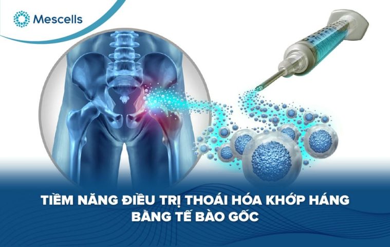 Tiềm năng điều trị thoái hóa khớp háng bằng tế bào gốc-01