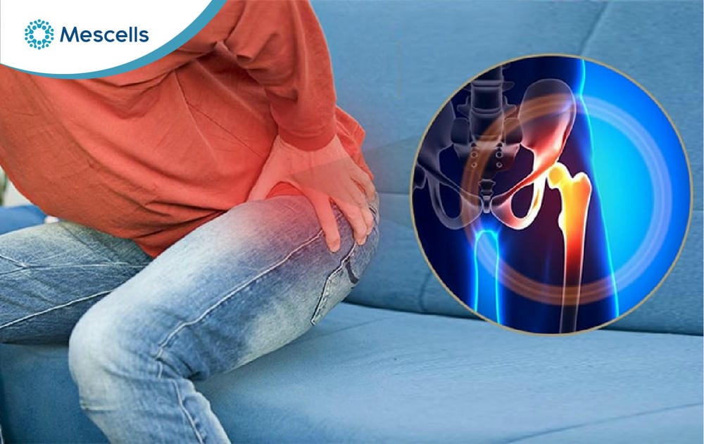 Tiềm năng điều trị thoái hóa khớp háng bằng tế bào gốc-02
