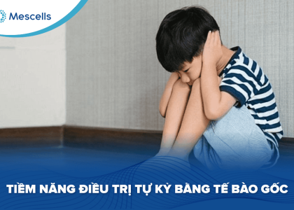 Tiềm năng điều trị tự kỷ bằng tế bào gốc-01