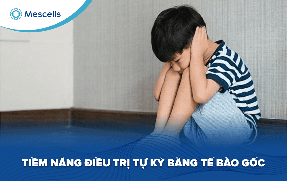 Tiềm năng điều trị tự kỷ bằng tế bào gốc-01