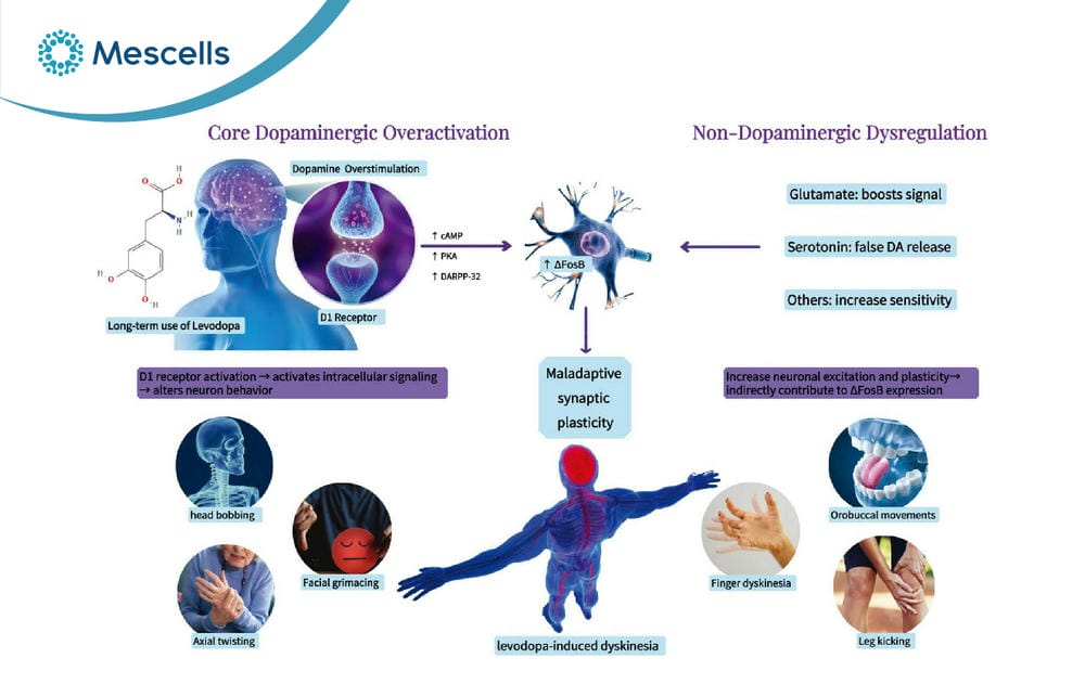 Điều trị Parkinson bằng tế bào gốc-03