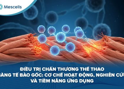 Điều trị chấn thương thể thao bằng tế bào gốc-01