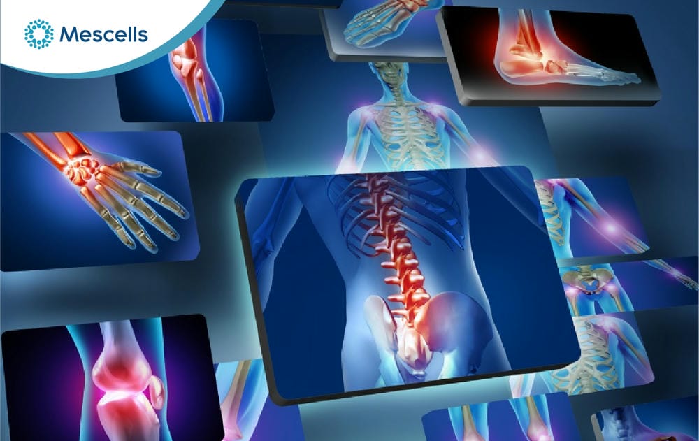 Điều trị chấn thương thể thao bằng tế bào gốc-03
