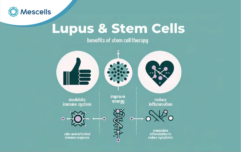 Điều trị lupus ban đỏ bằng tế bào gốc-09