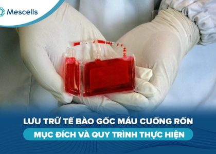 Lưu trữ tế bào gốc máu cuống rốn-01