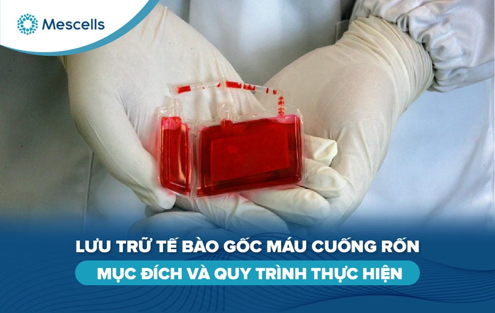 Lưu trữ tế bào gốc máu cuống rốn-01