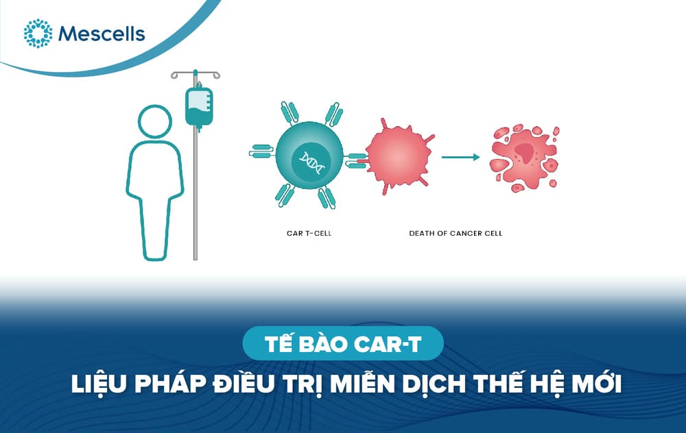 Tế bào CAR-T-01