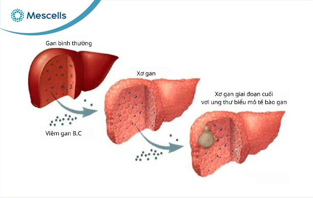 Tế bào gan là gì-11