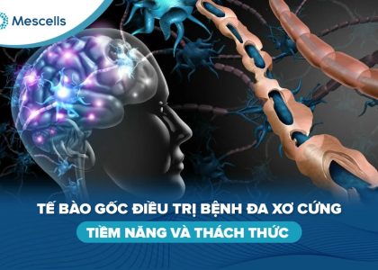 Tế bào gốc điều trị bệnh đa xơ cứng-01