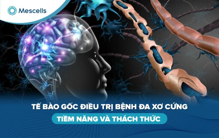 Tế bào gốc điều trị bệnh đa xơ cứng-01