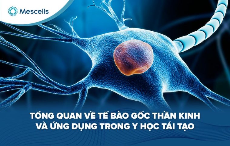 Tế bào gốc thần kinh-01