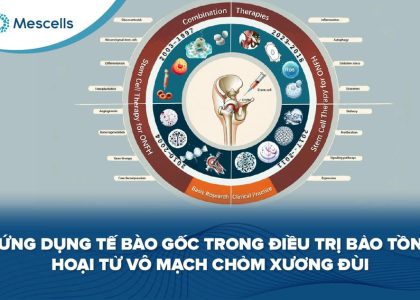 Tế bào gốc trong điều trị hoại tử chỏm xương đùi-01