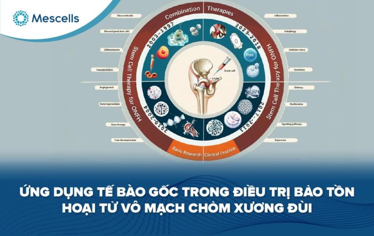 Tế bào gốc trong điều trị hoại tử chỏm xương đùi-01